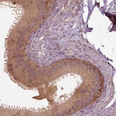 Immunohistochemistry-Paraffin: ERV3-1 Antibody [NBP2-62602]
