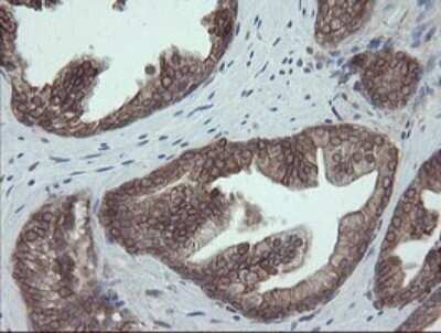 Immunohistochemistry: ERp57/PDIA3 Antibody (OTI3E1) [NBP2-46362]