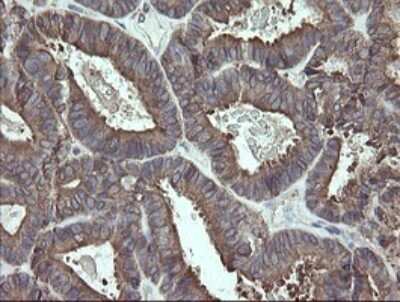 Immunohistochemistry: ERp57/PDIA3 Antibody (OTI3E1) [NBP2-46362]