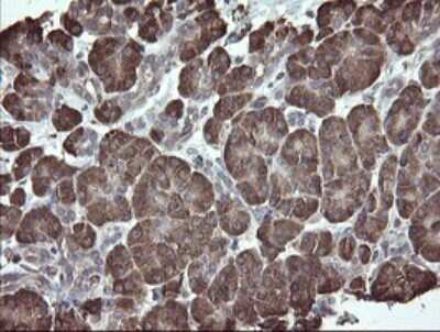 Immunohistochemistry: ERp57/PDIA3 Antibody (OTI3E1) [NBP2-46362]