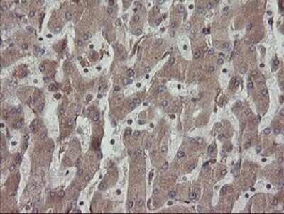 Immunohistochemistry: ERp57/PDIA3 Antibody (OTI3E1) [NBP2-46362]