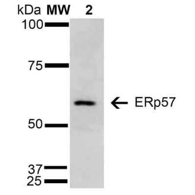Western Blot: ERp57/PDIA3 Antibody (4F9) [NBP2-59695]