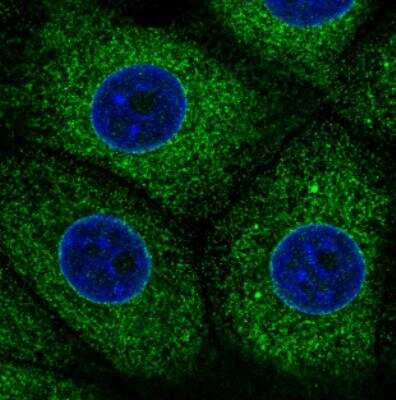 Immunocytochemistry/ Immunofluorescence: ERp57/PDIA3 Antibody (CL2444) [NBP2-36765]