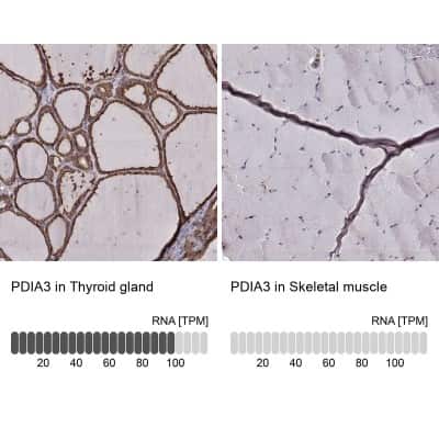 Immunohistochemistry-Paraffin: ERp57/PDIA3 Antibody (CL2444) [NBP2-36765]