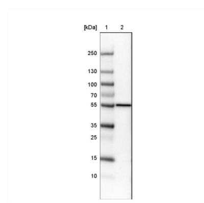 Western Blot: ERp57/PDIA3 Antibody (CL2446) [NBP2-36766]
