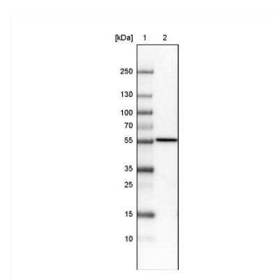 Western Blot: ERp57/PDIA3 Antibody (CL2452) [NBP2-36767]