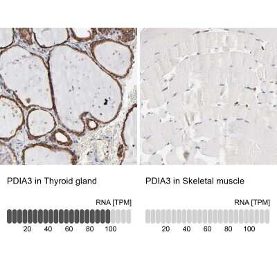 Immunohistochemistry-Paraffin: ERp57/PDIA3 Antibody [NBP1-84796]