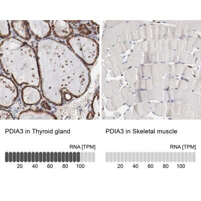 Immunohistochemistry-Paraffin: ERp57/PDIA3 Antibody [NBP1-84797]