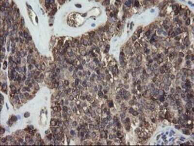 Immunohistochemistry: ERp57/PDIA3 Antibody (OTI3E1) - Azide and BSA Free [NBP2-70848]
