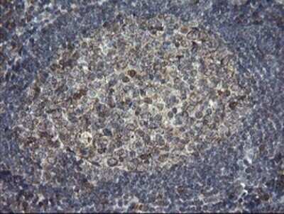 Immunohistochemistry: ERp57/PDIA3 Antibody (OTI3E1) - Azide and BSA Free [NBP2-70848]