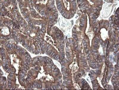 Immunohistochemistry: ERp57/PDIA3 Antibody (OTI4D7) - Azide and BSA Free [NBP2-70849]