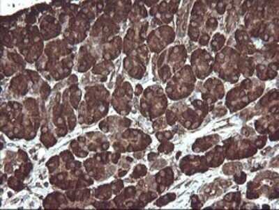 Immunohistochemistry: ERp57/PDIA3 Antibody (OTI4D7) - Azide and BSA Free [NBP2-70849]