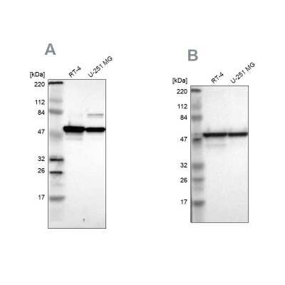 Western Blot: ERp57/PDIA3 Antibody [NBP1-84797]
