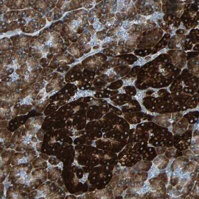 Immunohistochemistry-Paraffin: ERp72 Antibody [NBP1-84795]