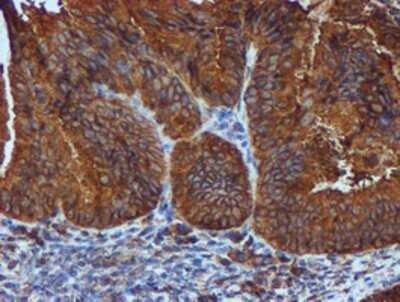 Immunohistochemistry: ERp72 Antibody (OTI2B9) - Azide and BSA Free [NBP2-71488]