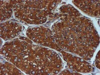 Immunohistochemistry: ERp72 Antibody (OTI2B9) - Azide and BSA Free [NBP2-71488]