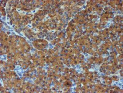 Immunohistochemistry: ERp72 Antibody (OTI2B9) - Azide and BSA Free [NBP2-71488]