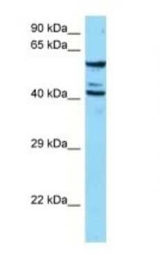 Western Blot: ESAM Antibody [NBP1-98329]