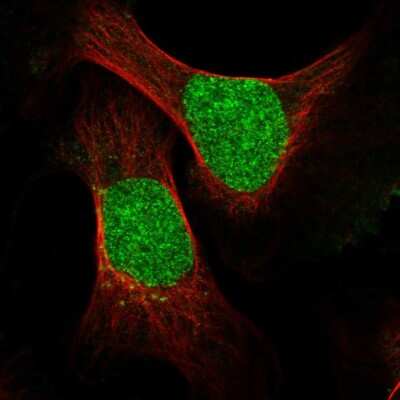 Immunocytochemistry/ Immunofluorescence: ESCO2 Antibody [NBP2-55577]