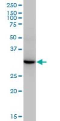Western Blot: ESD Antibody (1E1) [H00002098-M01]