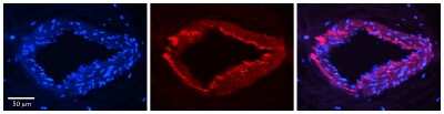 Immunohistochemistry: ESD Antibody [NBP1-57596]