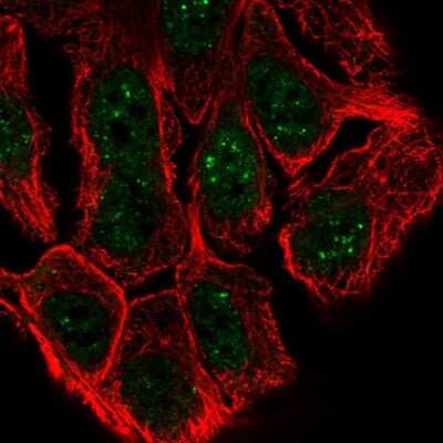 Immunocytochemistry/ Immunofluorescence: ESRP1 Antibody [NBP2-57822]