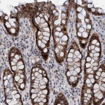 Immunohistochemistry-Paraffin: ESRP1 Antibody [NBP1-82202]