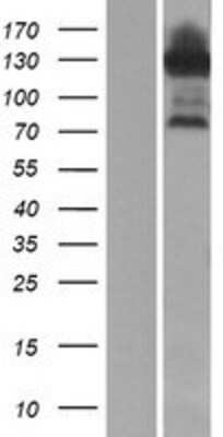 Western Blot: ESRP1 Overexpression Lysate [NBP2-06940]