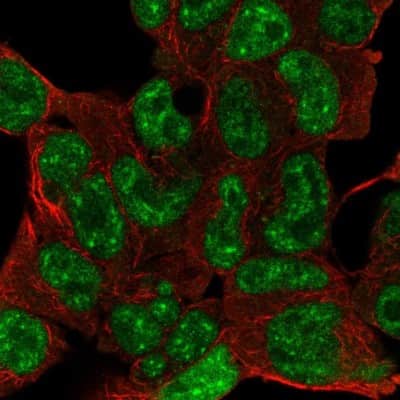 Immunocytochemistry/ Immunofluorescence: ESX1 Antibody [NBP2-13973]