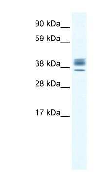 Western Blot: ESX1 Antibody [NBP1-80214]