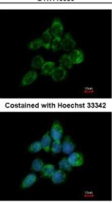 Immunocytochemistry/ Immunofluorescence: ETEA Antibody [NBP2-16381]