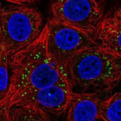 Immunocytochemistry/ Immunofluorescence: ETEA Antibody [NBP2-57425]