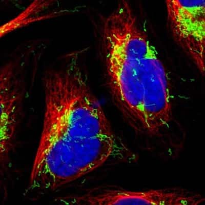 Immunocytochemistry/ Immunofluorescence: ETFA Antibody [NBP1-84854]