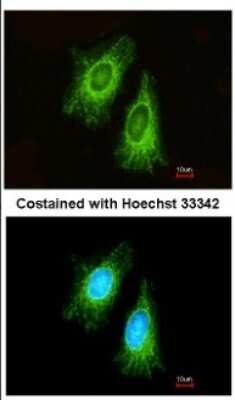 Immunocytochemistry/ Immunofluorescence: ETFA Antibody [NBP2-16383]