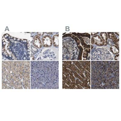Immunohistochemistry-Paraffin: ETFA Antibody [NBP1-84857]