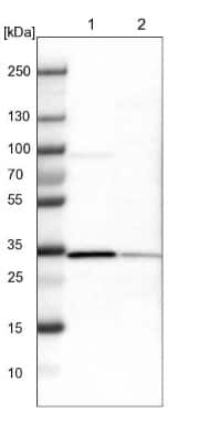 Western Blot: ETFA Antibody [NBP1-84856]