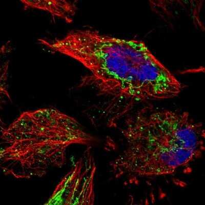 Immunocytochemistry/ Immunofluorescence: ETFB Antibody [NBP1-89545]