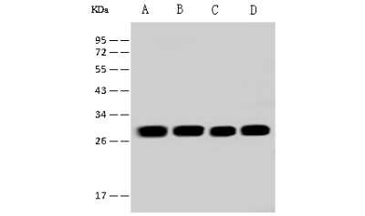 Western Blot: ETFB Antibody [NBP2-97524]
