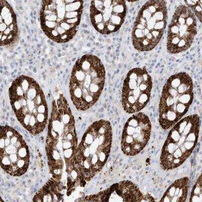 Immunohistochemistry-Paraffin: ETHE1 Antibody [NBP1-81688]