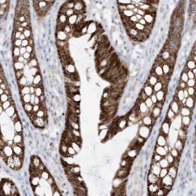 Immunohistochemistry-Paraffin: ETHE1 Antibody [NBP1-81688]