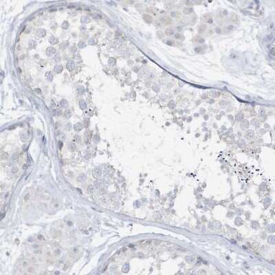 Immunohistochemistry-Paraffin: ETHE1 Antibody [NBP1-81688]