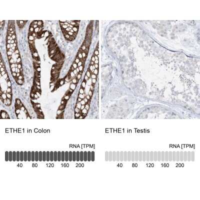 Immunohistochemistry-Paraffin: ETHE1 Antibody [NBP1-81688]