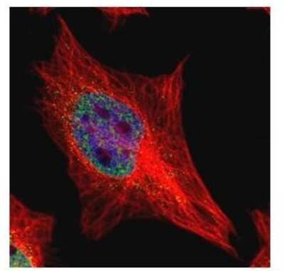 Immunocytochemistry/ Immunofluorescence: ETS1 associated protein II Antibody [NBP2-16386]