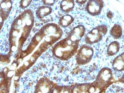 Immunohistochemistry-Paraffin: ETS1 associated protein II Antibody (TDP2/1258) - Azide and BSA Free [NBP2-50071]