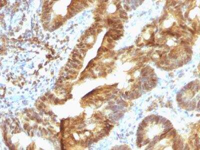Immunohistochemistry-Paraffin: ETS1 associated protein II Antibody (TDP2/1258) - Azide and BSA Free [NBP2-50071]