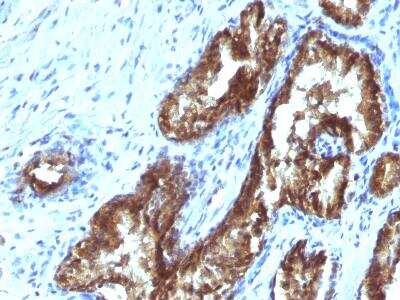 Immunohistochemistry-Paraffin: ETS1 associated protein II Antibody (TDP2/1258) [NBP2-50070]