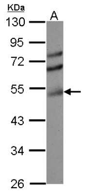 Western Blot: ETS1 associated protein II Antibody [NBP2-16386]