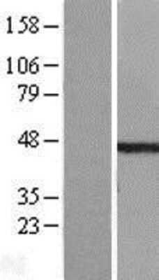 Western Blot: ETS1 associated protein II Overexpression Lysate [NBL1-17424]