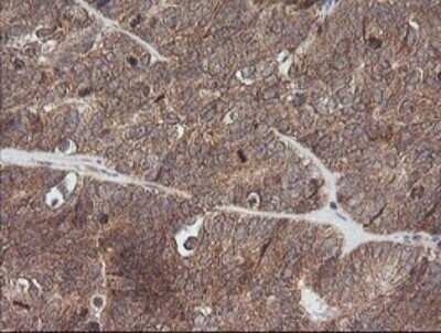 Immunohistochemistry: ETS2 Antibody (OTI2A3) - Azide and BSA Free [NBP2-70694]