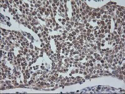 Immunohistochemistry: ETS2 Antibody (OTI2A3) - Azide and BSA Free [NBP2-70694]